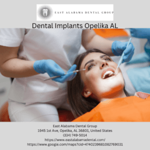 dental implants opelika alabama